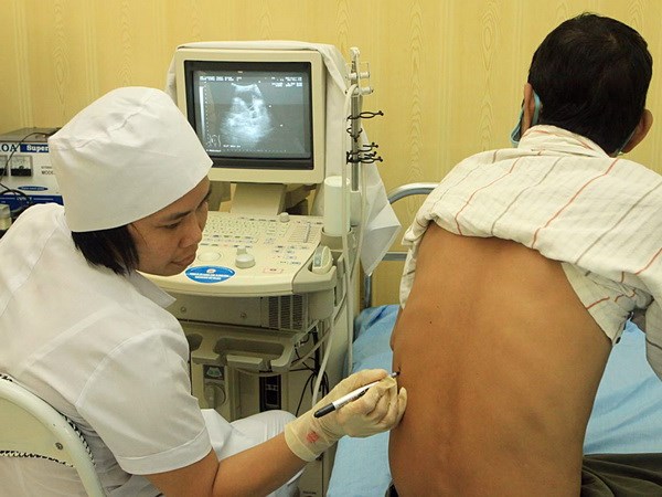 Ha Noi accelerates efforts to reduce new tuberculosis cases- Ảnh 1.