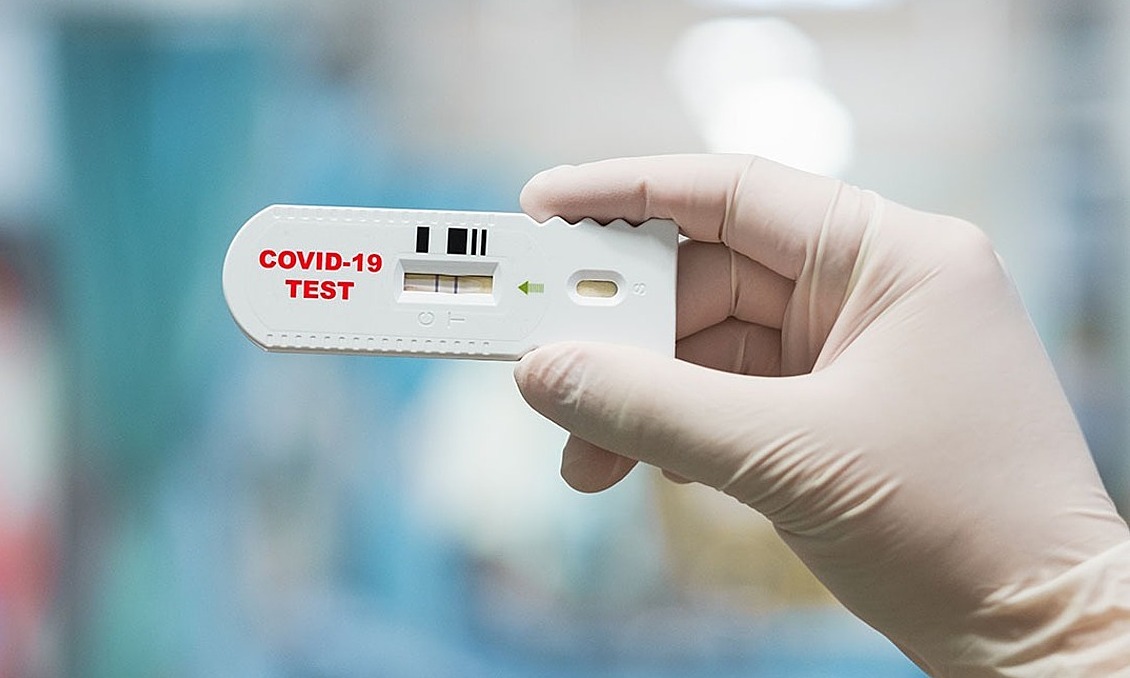 Test nhanh: Hãy xem hình ảnh để tìm hiểu những ưu điểm và tính năng của các loại test nhanh, giúp chúng ta có thể tăng cường khả năng phát hiện virus và điều trị kịp thời.