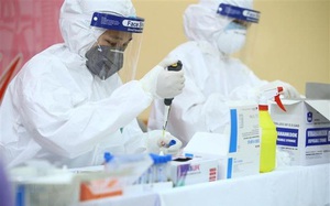 Quy định giá dịch vụ xét nghiệm COVID-19 không do Quỹ BHYT thanh toán
