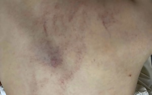 Hà Nội khẩn trương xác minh việc trẻ mầm non nghi bị giáo viên bạo hành