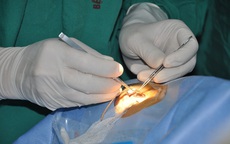 Nguồn m&#244; gh&#233;p gi&#225;c mạc vẫn c&#242;n hạn chế