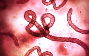 Chủ động các biện pháp phòng ngừa, ngăn chặn dịch bệnh Ebola xâm nhập